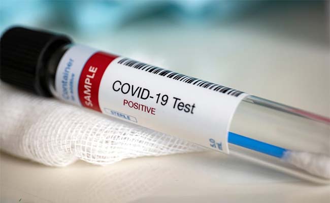 Covid Testing