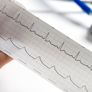 12 Lead ECG